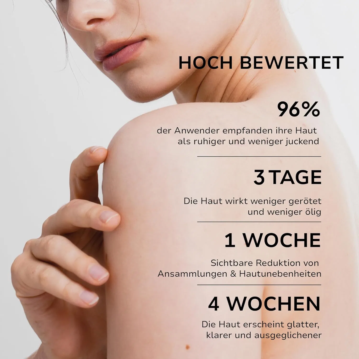Лосьон Bellamiluxx — Fungal Acne Treatment для кожи, склонной к грибковым высыпаниям — фото 3