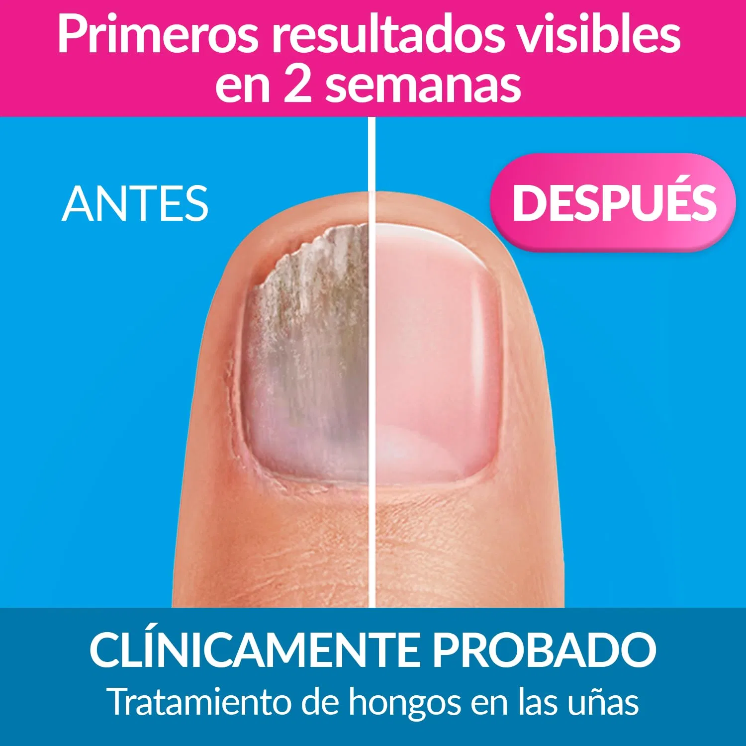 Лак для ногтей «ESMALTE ONIMICOSIS UÑAS» от EXCILOR 3.3 мл Excilor — фото 3