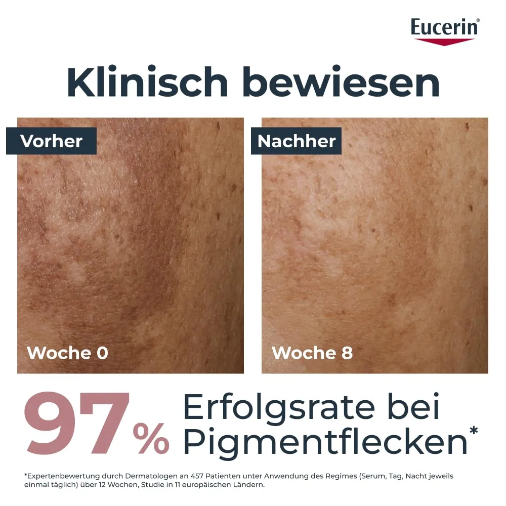 Сыворотка Eucerin — Двойная «Anti-Pigment Dual Serum» от — фото 3