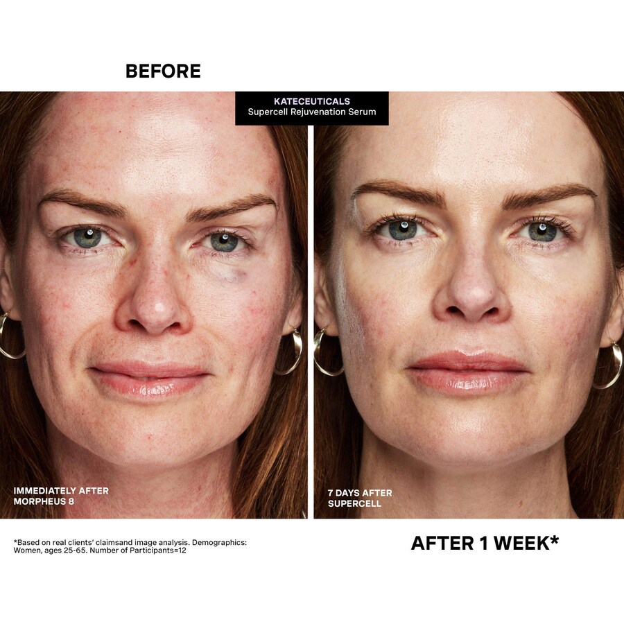 Бустер Kate Somerville — Для омоложения SuperCell от KateCeuticals с пептидами — фото 3