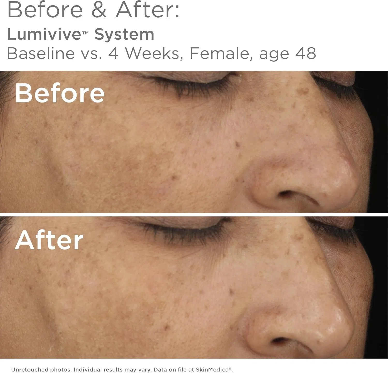 Дневной крем SkinMedica Lumive — фото 4