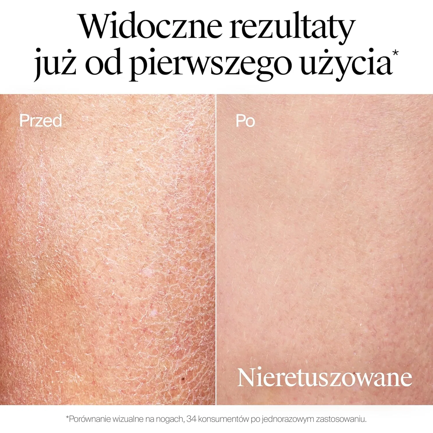 Увлажняющий лосьон-масло «Norwegian Formula Deep Moisture» от Neutrogena Neutrogena — фото 3
