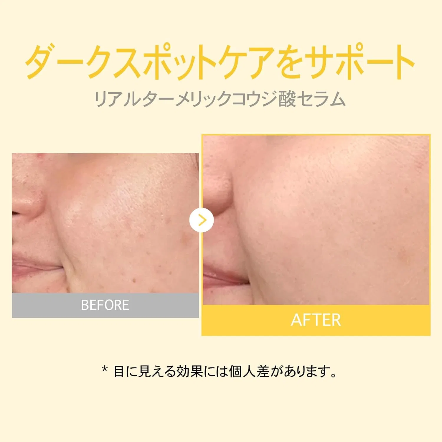 Сыворотка Tosowoong — С куркумой и койевой кислотой Real Termeric Coric Acid Serum, 33 мл — фото 4