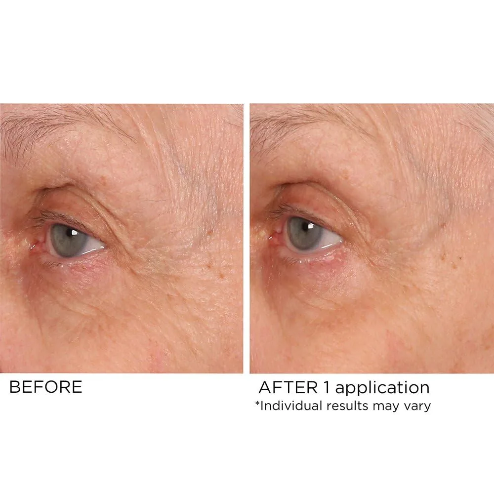 Сыворотка для обновления кожи вокруг глаз NASSIFMD Age Defying Eye Renewal Serum - двойное действие, пептидное осветление, борьба с морщинами, отечностью и темными кругами. — фото 3