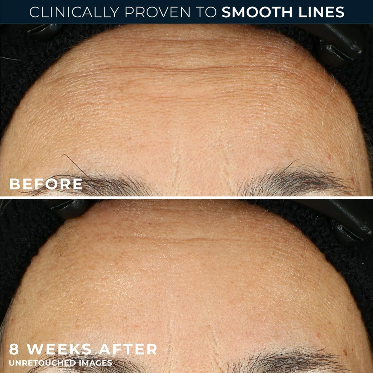 Сыворотка RoC — Ночная с ретинолом Retinol Correxion, 10.5 мл — фото 4