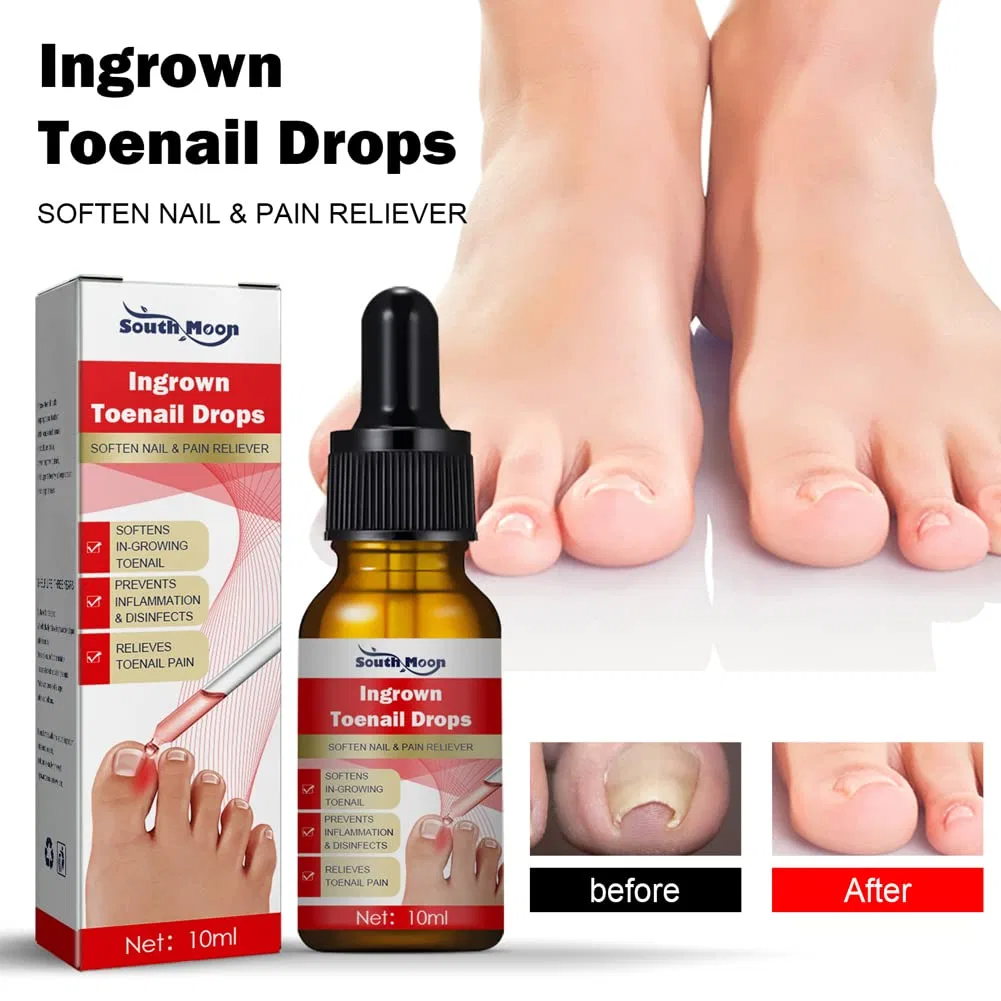 Масло для кутикулы NailHelper для вросших ногтей Zuicc — фото 2