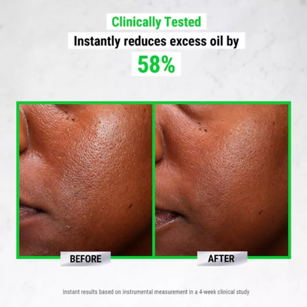 Сыворотка Kiehl's — Ультрачистая высокоэффективная с , % ниацинамидом Since — фото 2