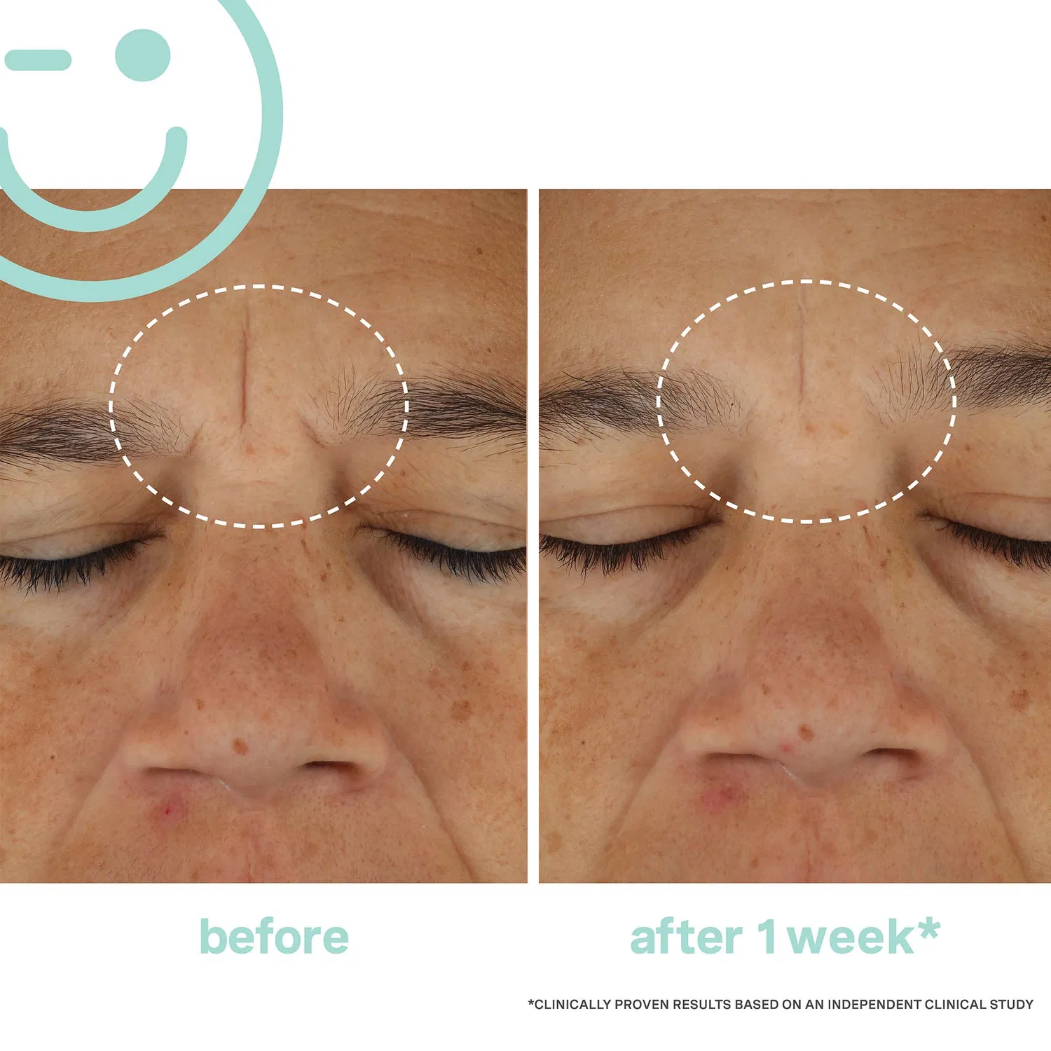 Крем для лица SPF KATE SOMERVILLE Hydrakate crema idratante rinvigorente — фото 3