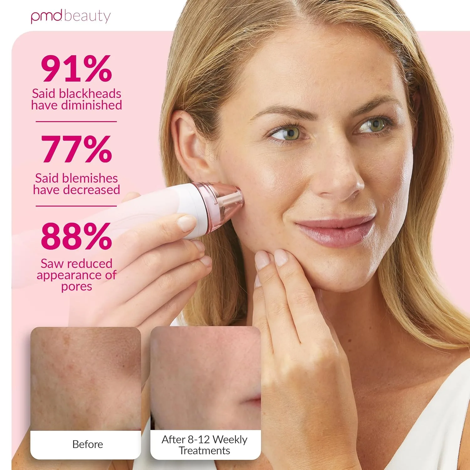 PMD Beauty Personal Microderm Pro - Инструмент для микродермабразии для домашнего использования, отшелушивающий скраб для лица и тела., Blush — фото 4