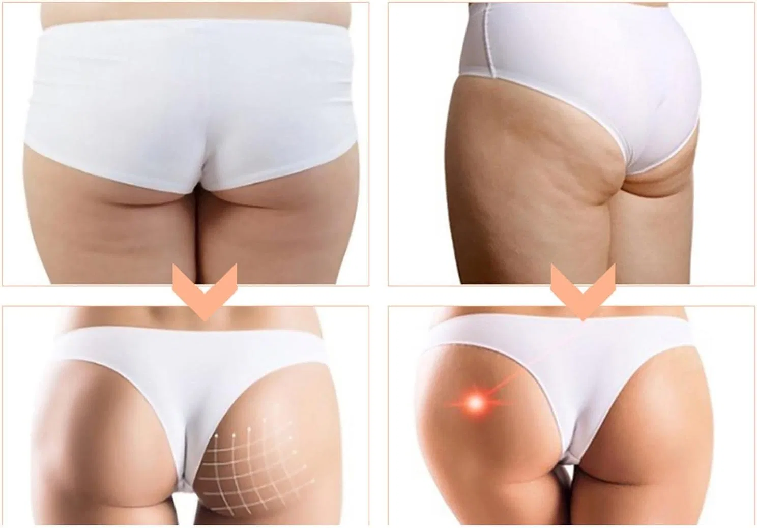 Набор масел для подтяжки ягодиц SnowingShine, 3 шт, 4 упаковки