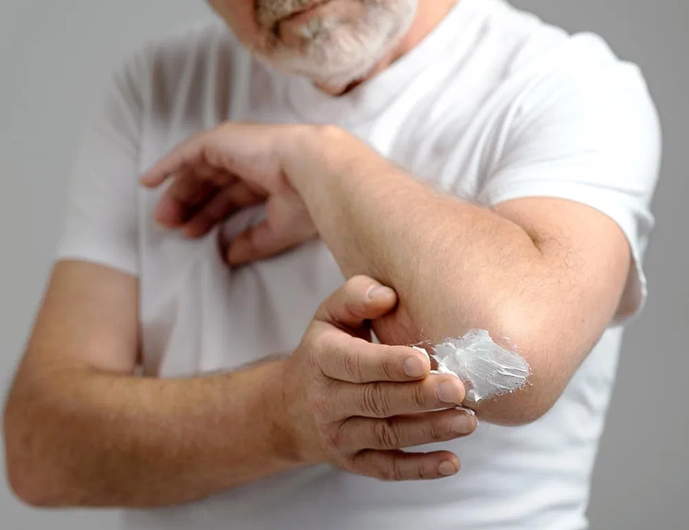 Бальзам DermaAktiv для уменьшения мозолей, 75% за 28 дней Hydas — фото 4