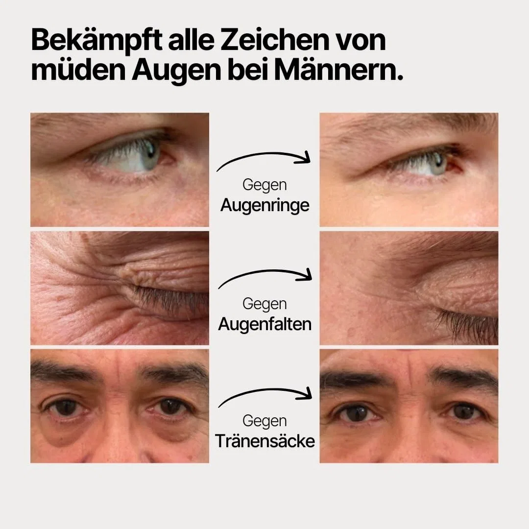 Мужская сыворотка для глаз «Eye Serum Men» от MaleUp Maleup — фото 2