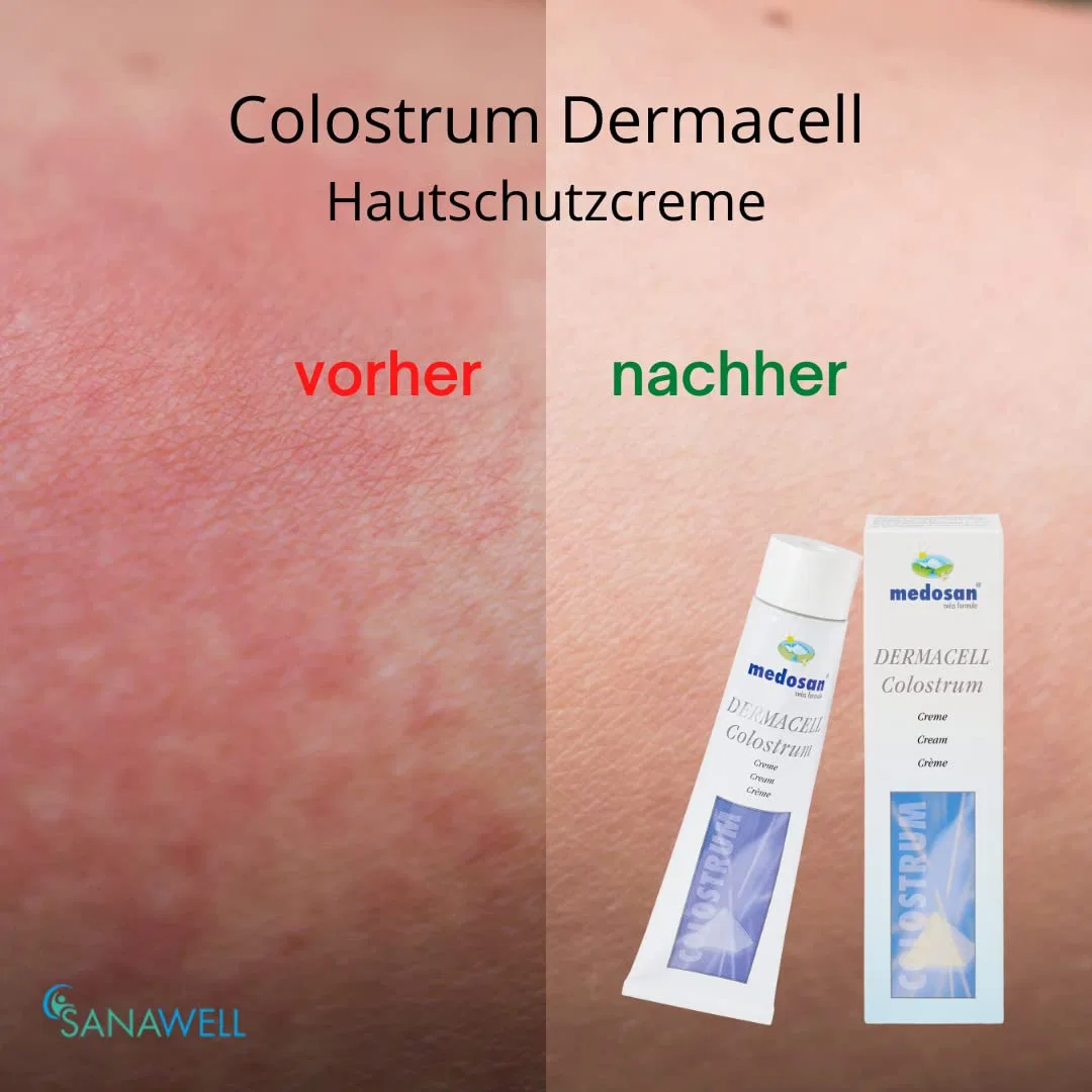 Крем для защиты кожи Colostrum Dermacell, набор из 2 шт. Medosan — фото 2