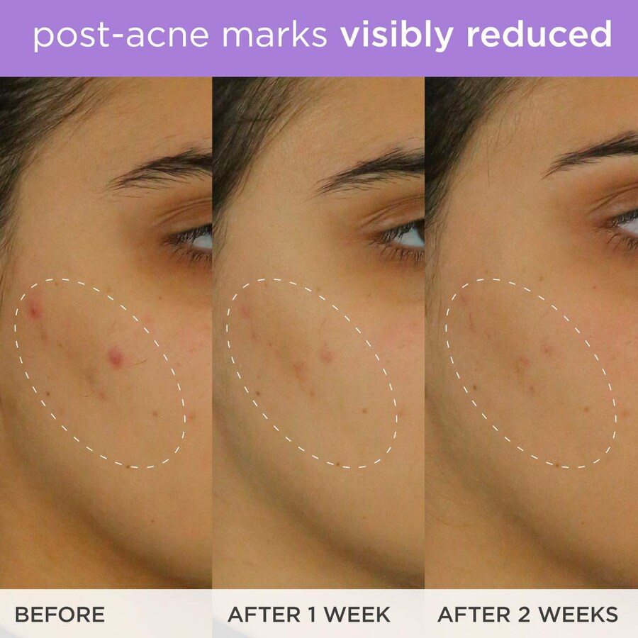 Бустер Tatcha — Осветляющая и подтягивающая с витамином С и феруловой кислотой, 30 мл — фото 3