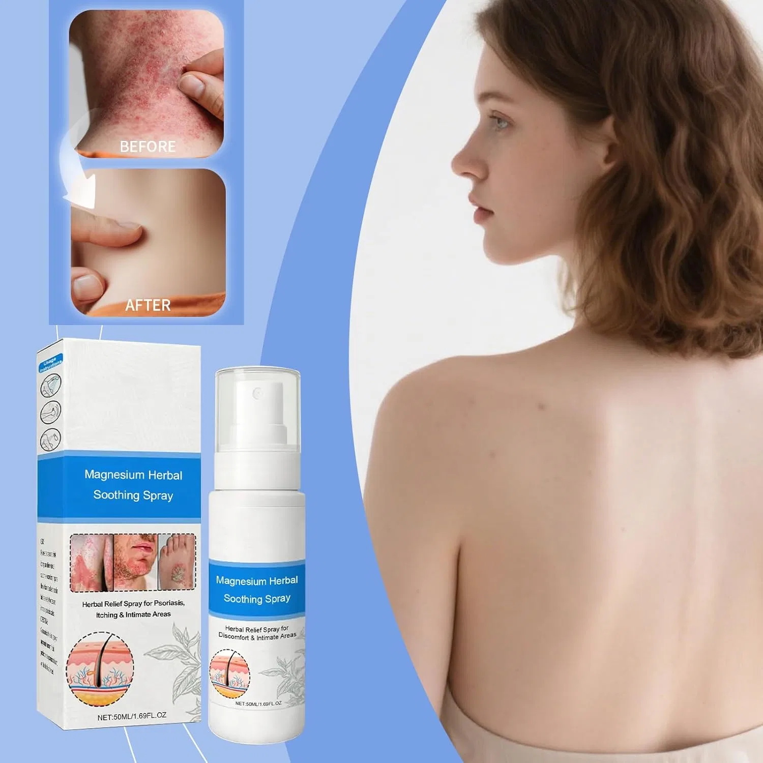 Спрей Zvoevo Magnesium Herbal Psoriasis для кожи (3 шт.) ‎Generisch, 3 Items — фото 2