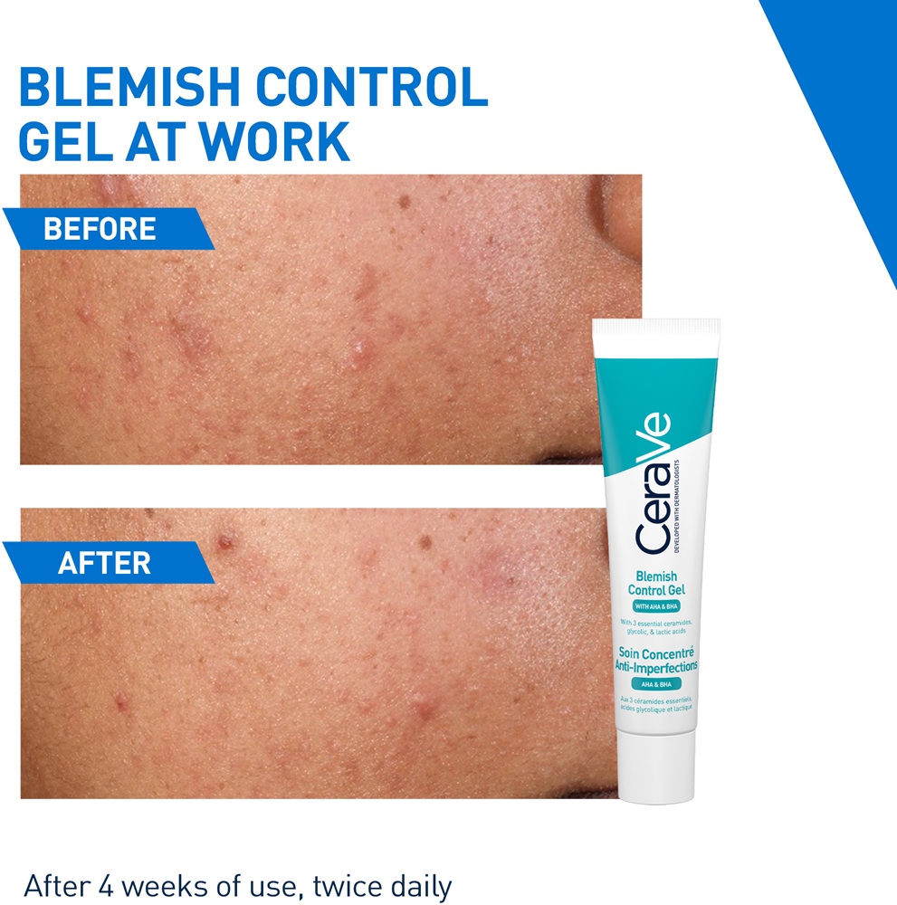 Крем для лица SPF CERAVE Гель AHA & BHA Acne Control — фото 3