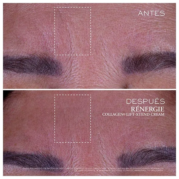 Антивозрастной крем для лица LANCOME Rénergie Collagen Lift-Xtend Cream 50 мл — фото 3