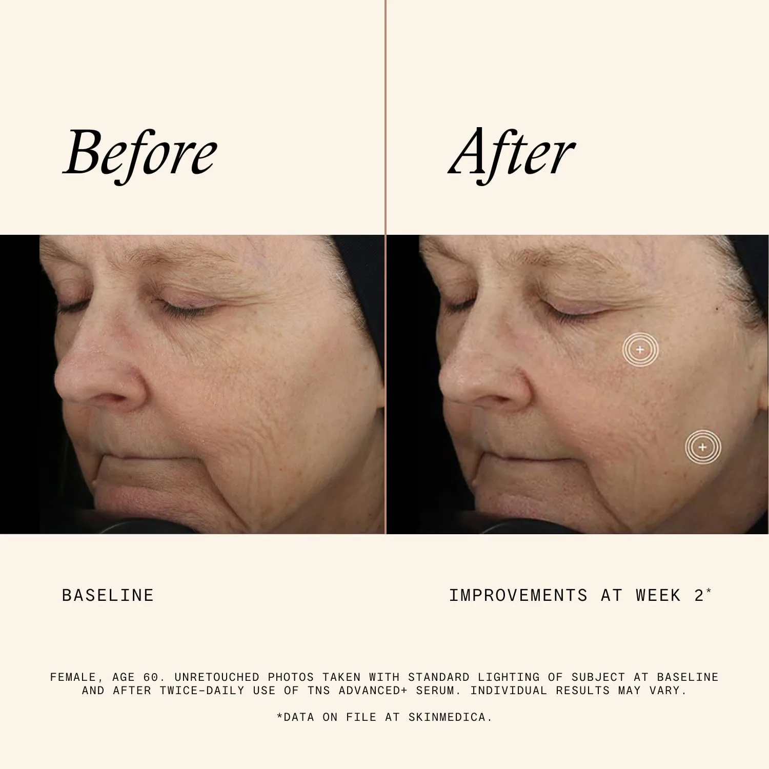 Сыворотка для лица SkinMedica TNS Advanced+ (НОВАЯ УПАКОВКА) - Мультипептидная сыворотка для улучшения внешнего вида морщин, тонких линий, тона и текстуры кожи (30 мл), Green — фото 4