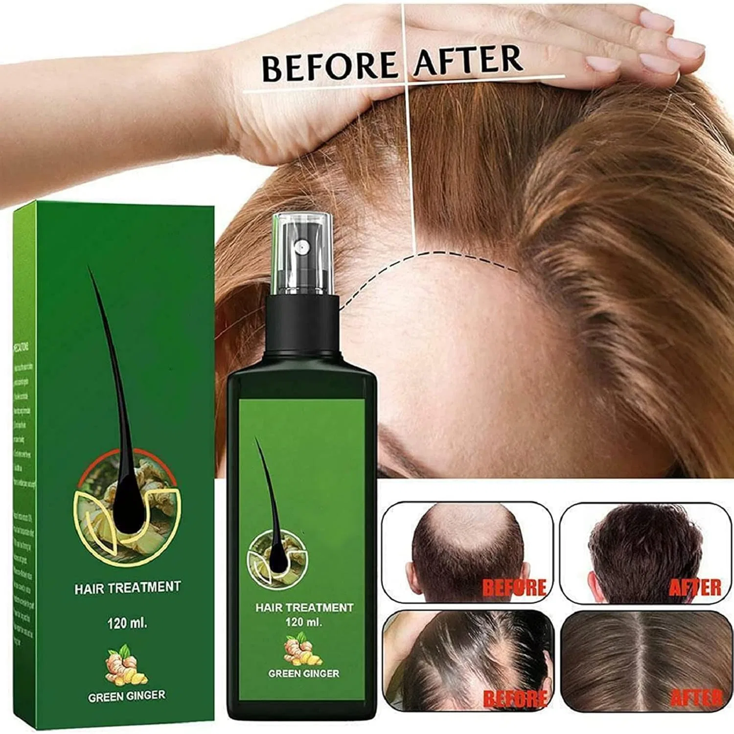 Сыворотка для роста волос Nourishing Ginger Spray, 2 шт. Zrremre, Set Of 2 — фото 4