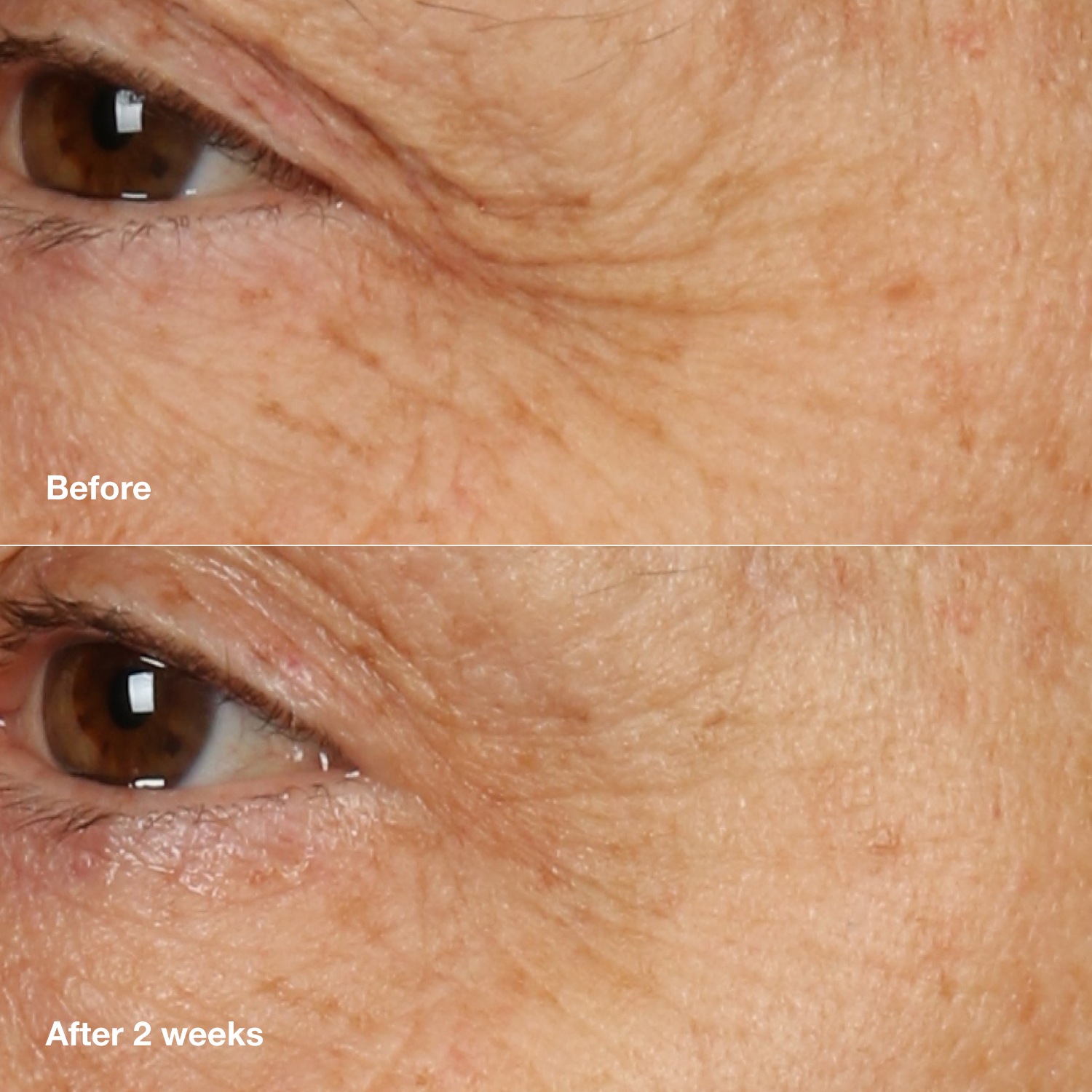 Сыворотка Clinique — Smart smart clinical repair overnight cream & mask , объем, 50 мл — фото 4