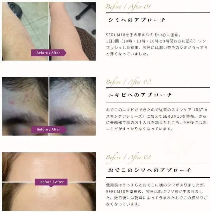 Сыворотка — Для лица с % стволовых клеток человека Latia Luxury Serum, 30 мл — фото 4