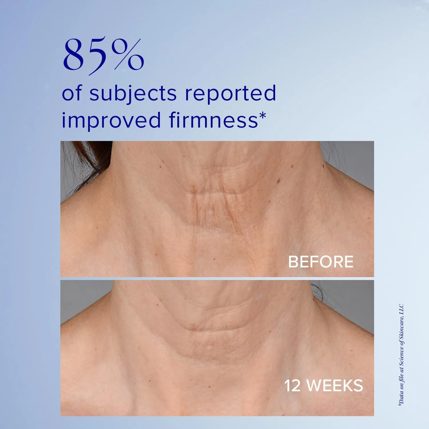 Крем для лица IS Clinical — Neckperfect Complex, для укрепления кожи шеи, антивозрастной лифтинг- для шеи, для — фото 3