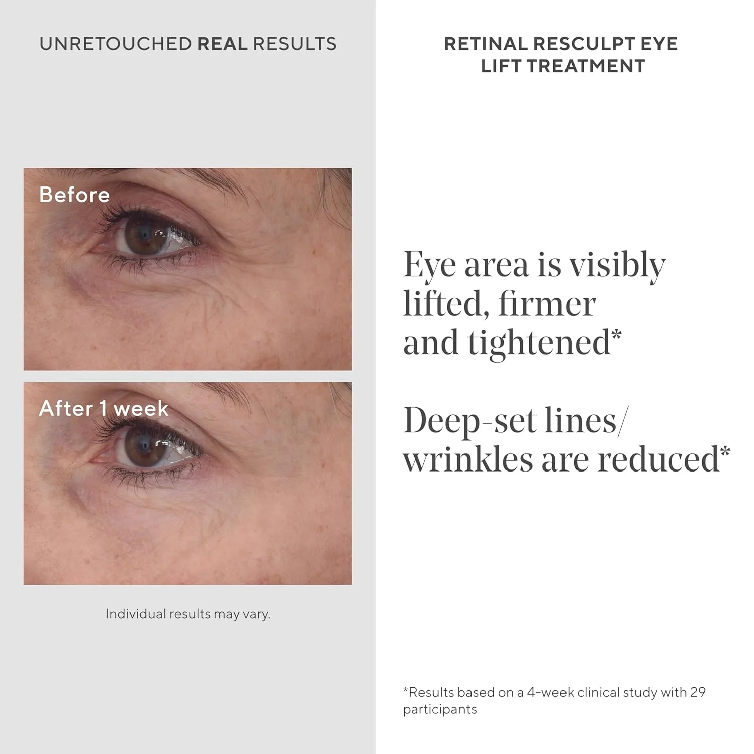 Murad Retinal Eye & Night Combo: Retinal ReSculpt Eye Lift Treatment и Overnight Cream для молодости глаз и упругой, подтянутой, увлажненной кожи, набор из 2 шт — фото 3