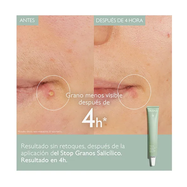 Масло для лица Caudalie — Остановить салициловые прыщи Vinopure, 15 мл — фото 2