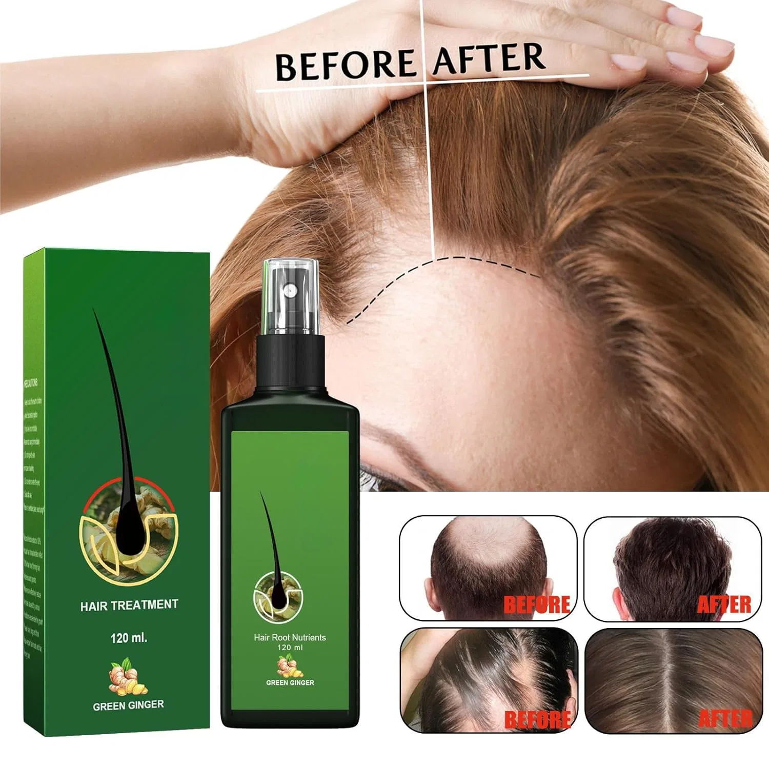 Сыворотка для роста волос Anti Hair Loss для ускоренного роста Mrinb, 5 X 120 Ml — фото 3