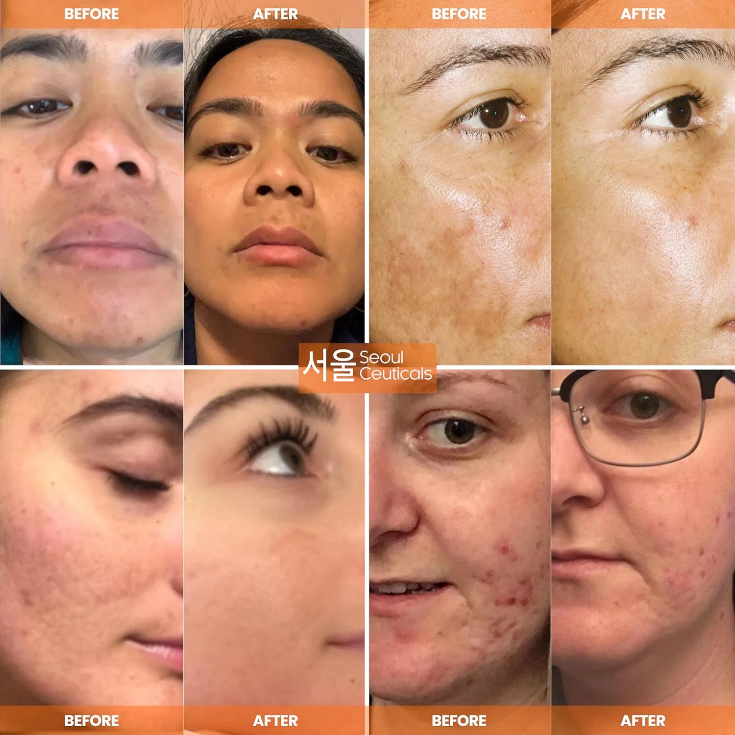 Сыворотка SeoulCeuticals — Для лица «CE Ferulic Serum» с витамином C, E и гиалуроновой кислотой от Seoul Korean Skin — фото 3