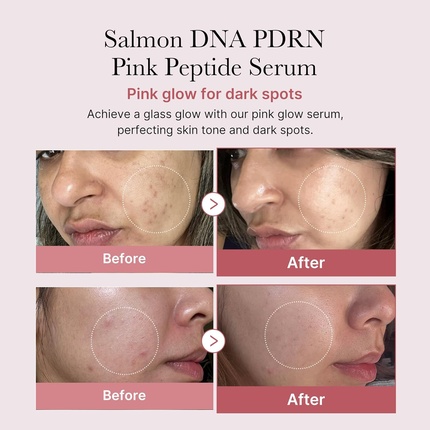 Сыворотка для сияния кожи Medicube PDRN Pink Peptide, с розовым PDRN и пептидами, 30 мл — фото 3