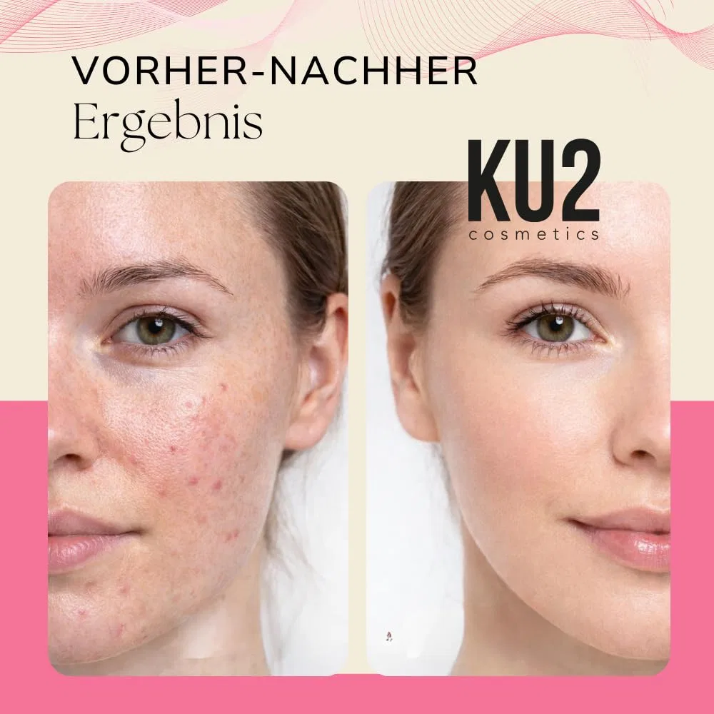 Сыворотка Ku2 Cosmetics — Для лица с ниацинамидом «Balancing Complexion» от, 30 мл — фото 4