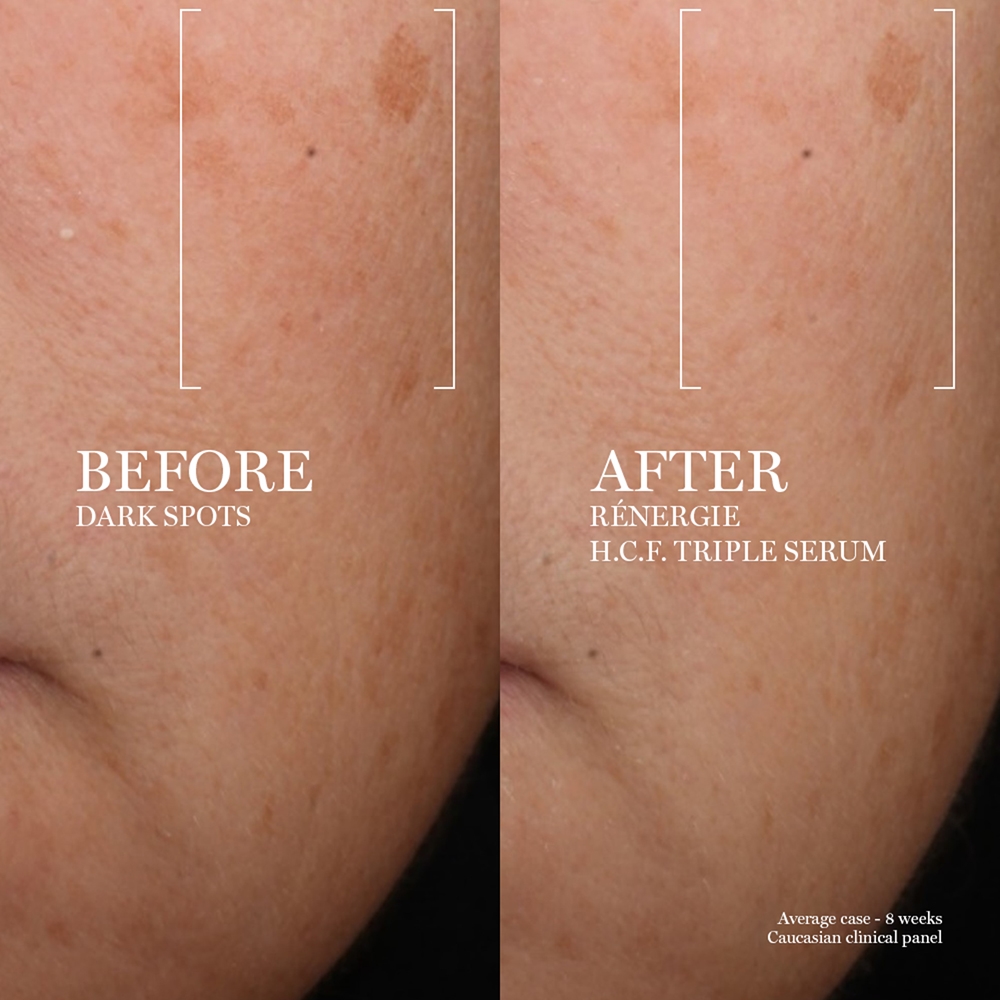 Сыворотка Lancôme — Для лица Rénergie hcf Triple Serum , moterims, 50 мл — фото 4