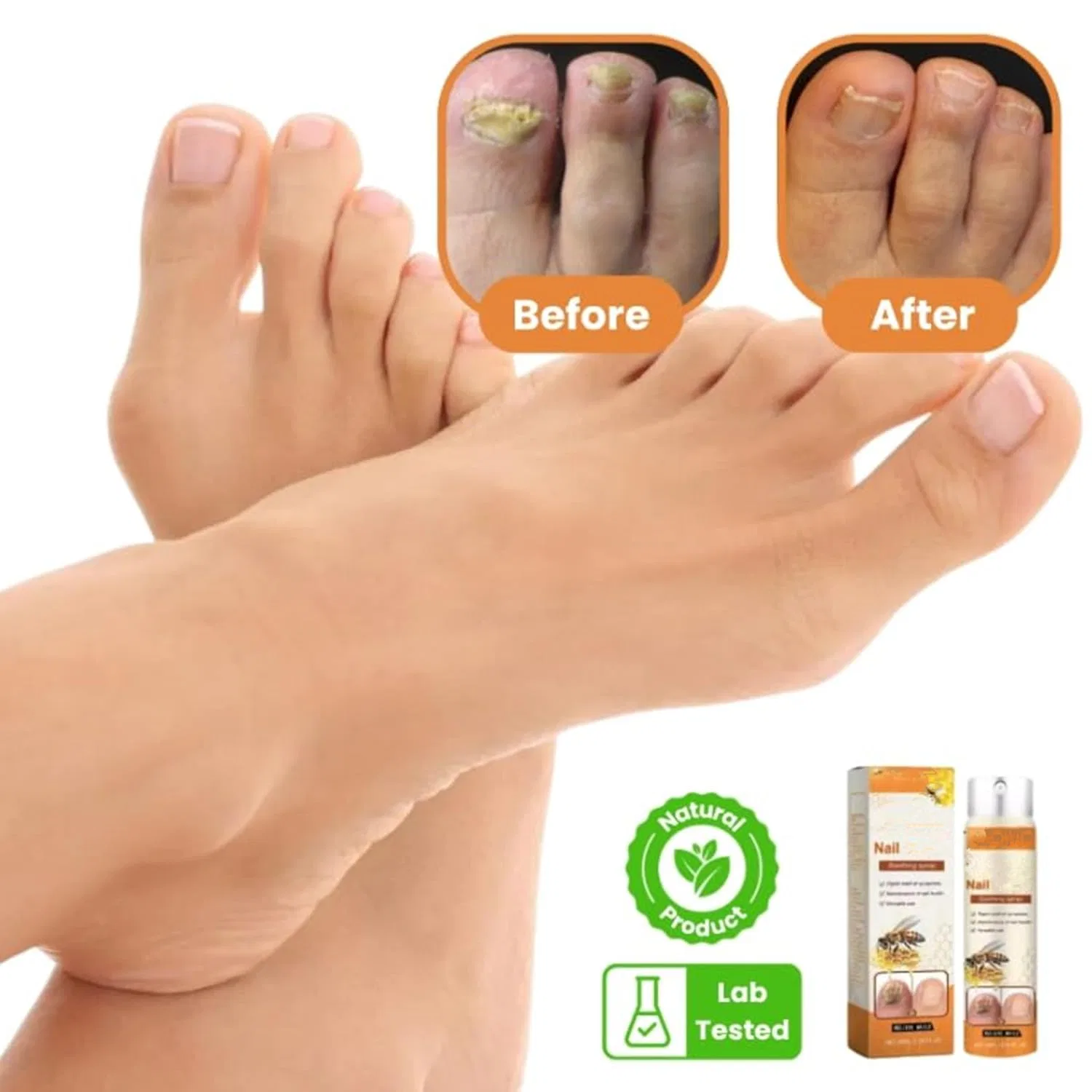 Спрей для восстановления ногтей Timilk Fungibee Advanced Nail Repair, 20 мл Petsburg — фото 3