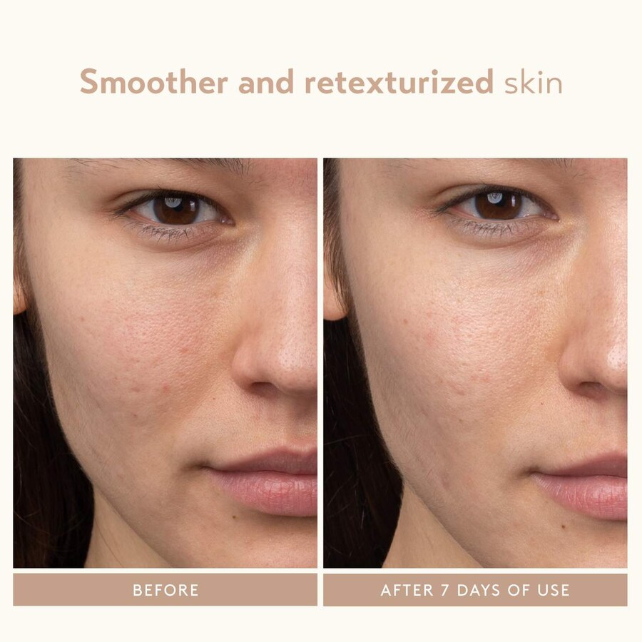 Сыворотка Shani Darden Skin Care — Отшелушивающая с молочной кислотой и AHA-кислотами, 30 мл — фото 3