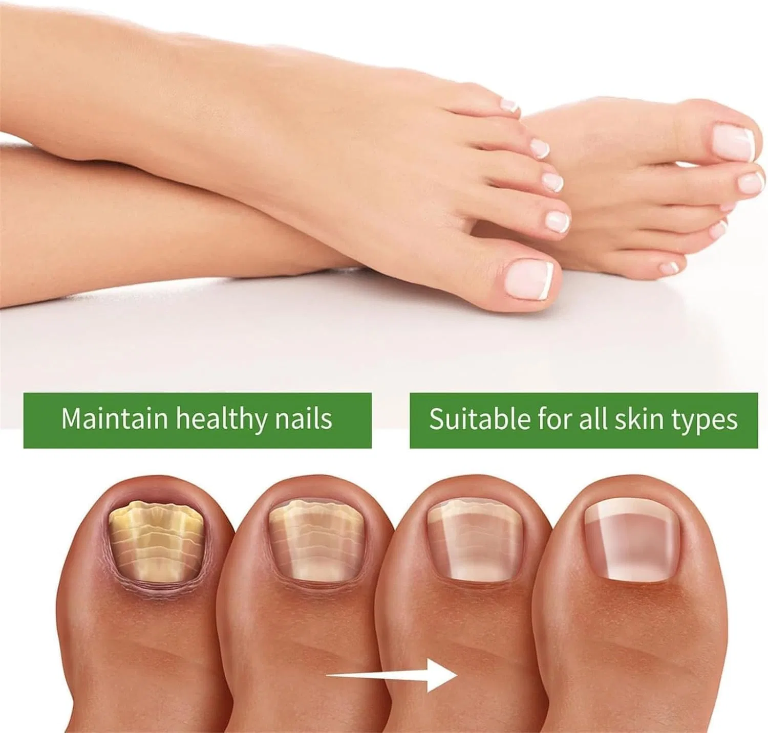 Стик-укрепитель для ногтей Monsalife Nailshield Anti Fungal Stick 10 мл Erisamo — фото 4