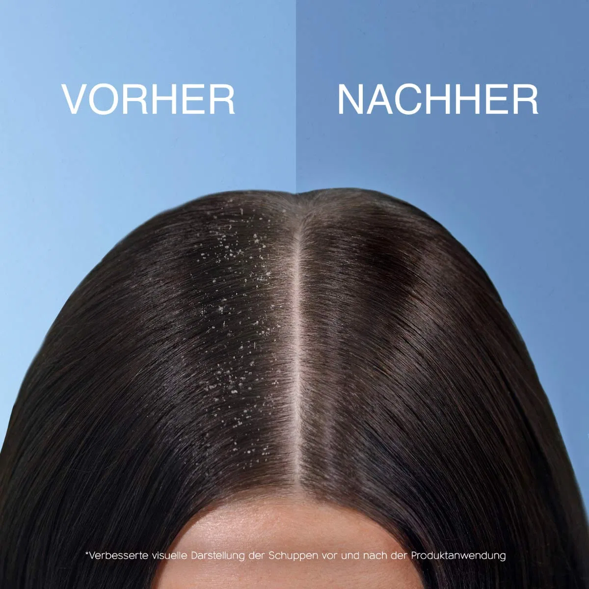 Шампунь против перхоти «Apple Fresh» от Head & Shoulders ‎Head & Shoulders — фото 4