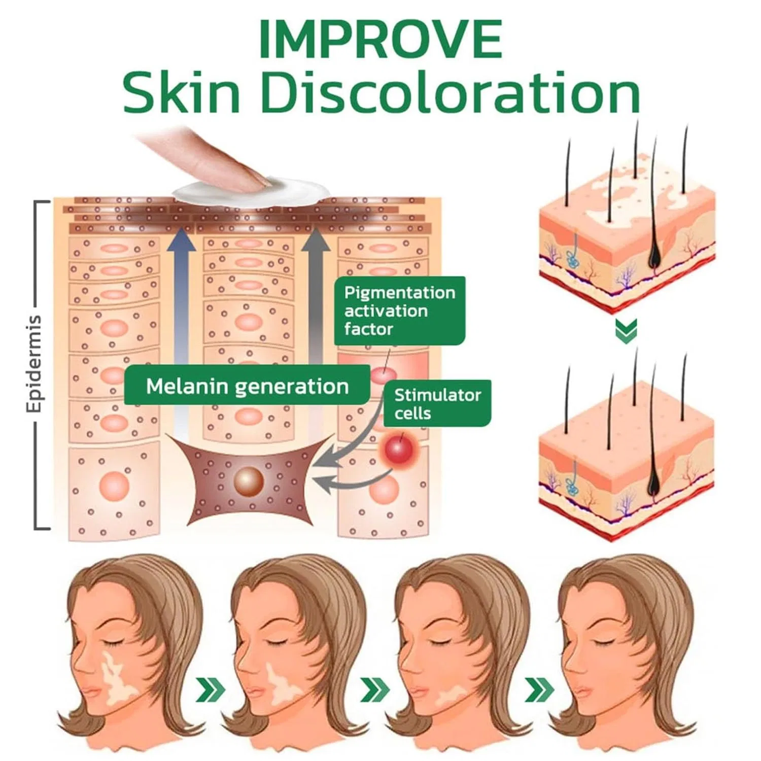 Крем для лица Ashopfun — Для лечения витилиго «Vitiligo Fix Revitalize Elixir» , 3 Pieces, 15 г — фото 4