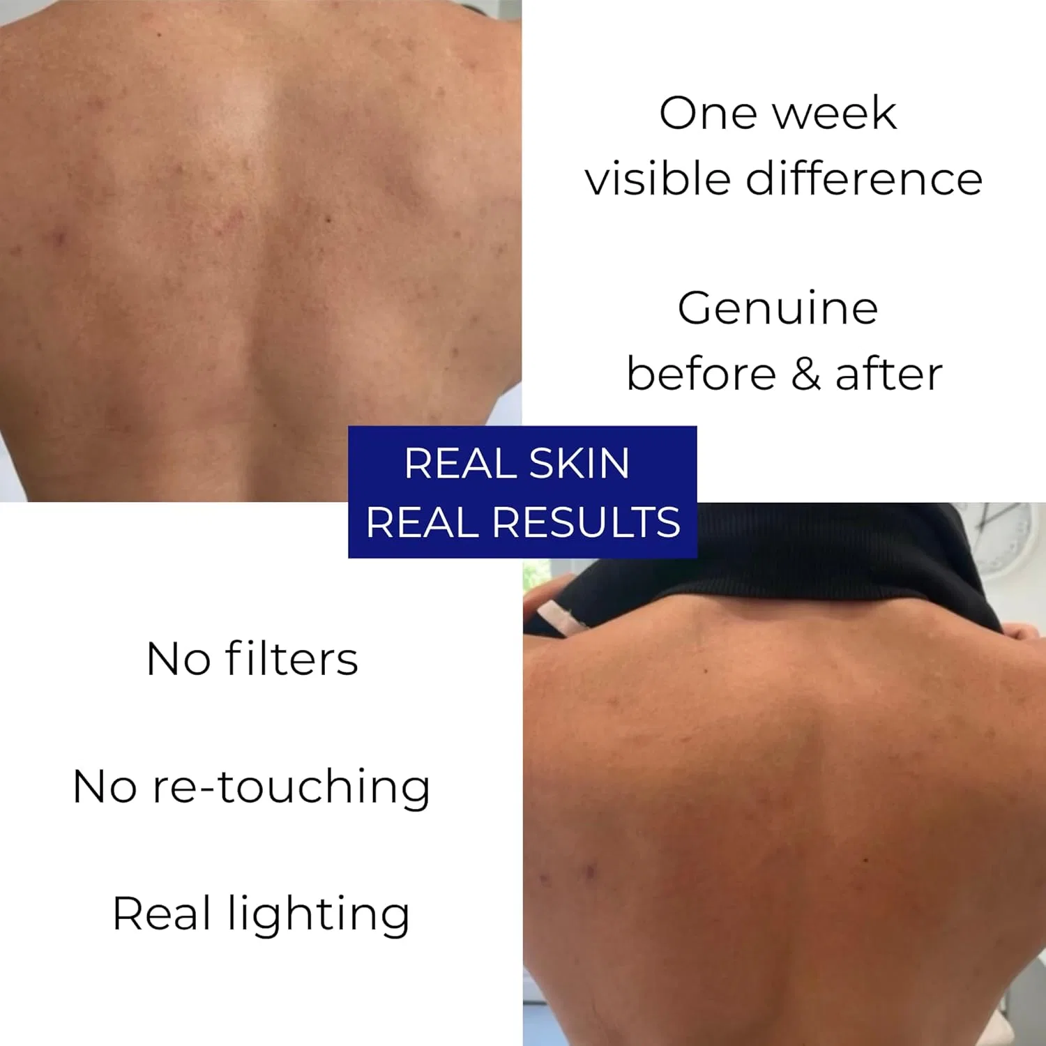 Скраб для тела BHA с салициловой и гликолевой кислотой Skin Hydroxy — фото 2