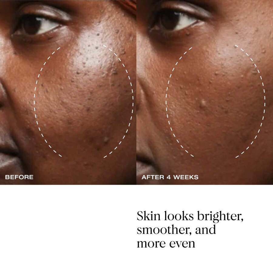Сыворотка YSE Beauty — Утренний коктейль: с витамином С, ниацинамидом и азелаиновой кислотой, 30 мл — фото 3