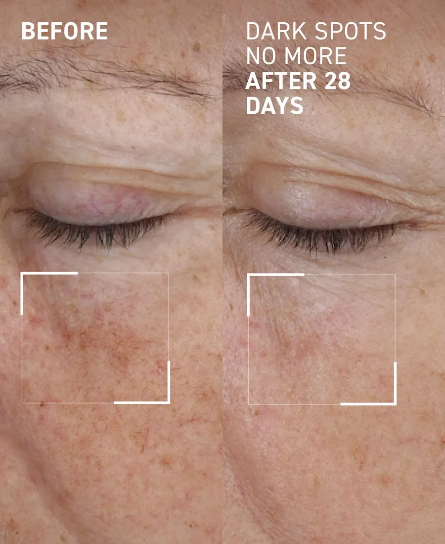 Сыворотка Dr. Brandt — Концентрат для уменьшения пигментных пятен Dark Spots No More Triple Acid — фото 2