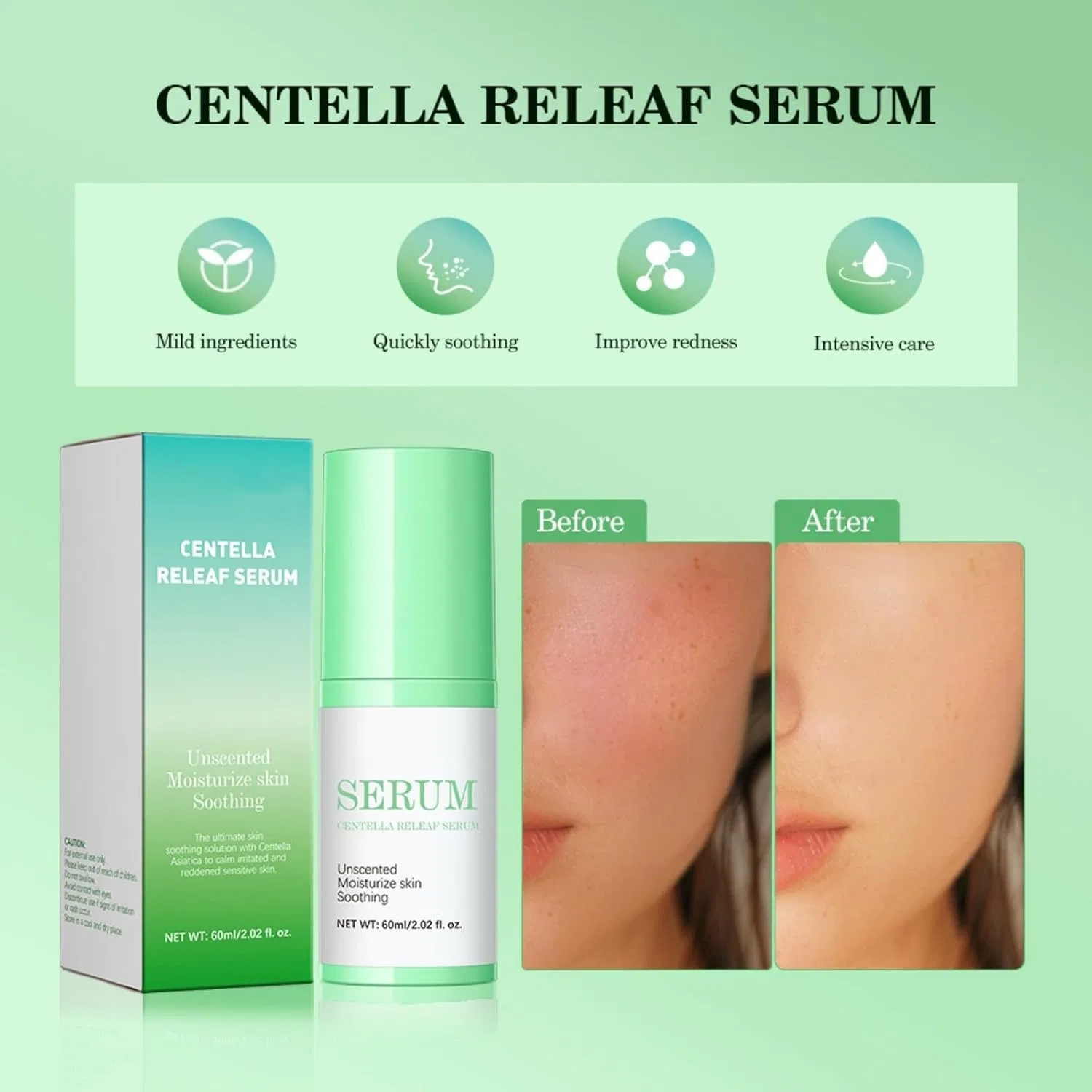 Эссенция успокаивающая Centella Asian Tica Moist Mild White Perfect Essence 60 мл Generic — фото 2