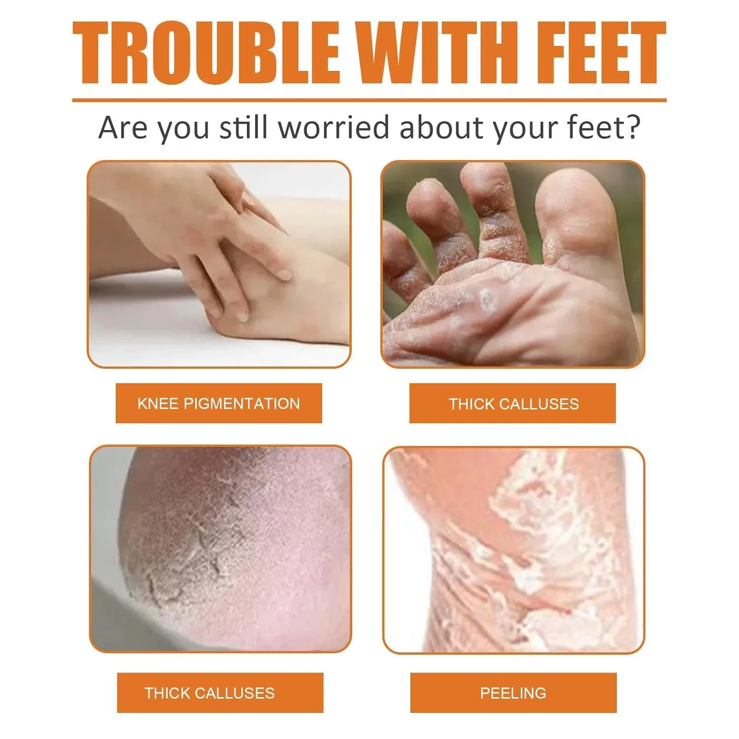 Спрей для удаления мозолей Gfouk Foot Callus Removal Spray, 30 мл ‎Flluouzh — фото 4
