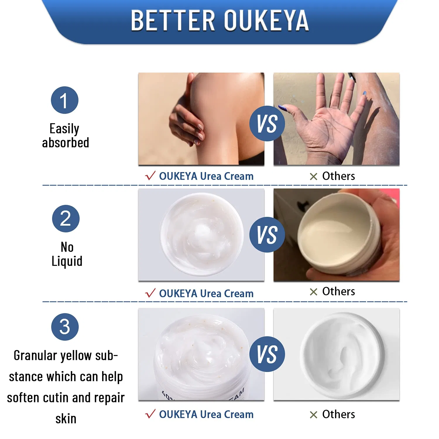 Крем для ног и рук с 40% мочевиной от OUKEYA Oukeya — фото 3