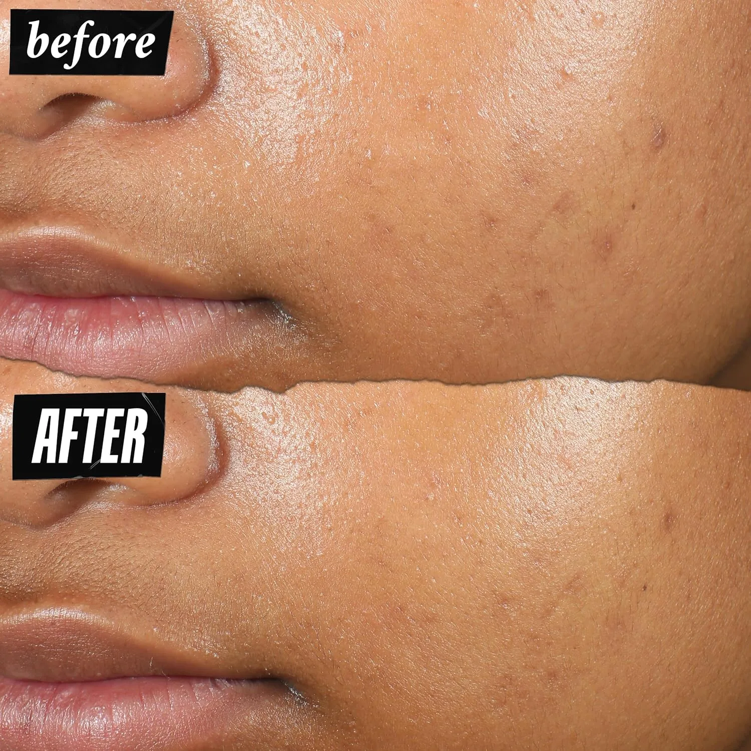 Kiehl's Truly Targeted Acne-Clearing Pimple Patch с 2% салициловой кислотой, невидимое жидкое средство для точечного применения, 4% ниацинамид для осветления следов, 0.2% корень солодки для снятия покраснений - 15 мл — фото 4
