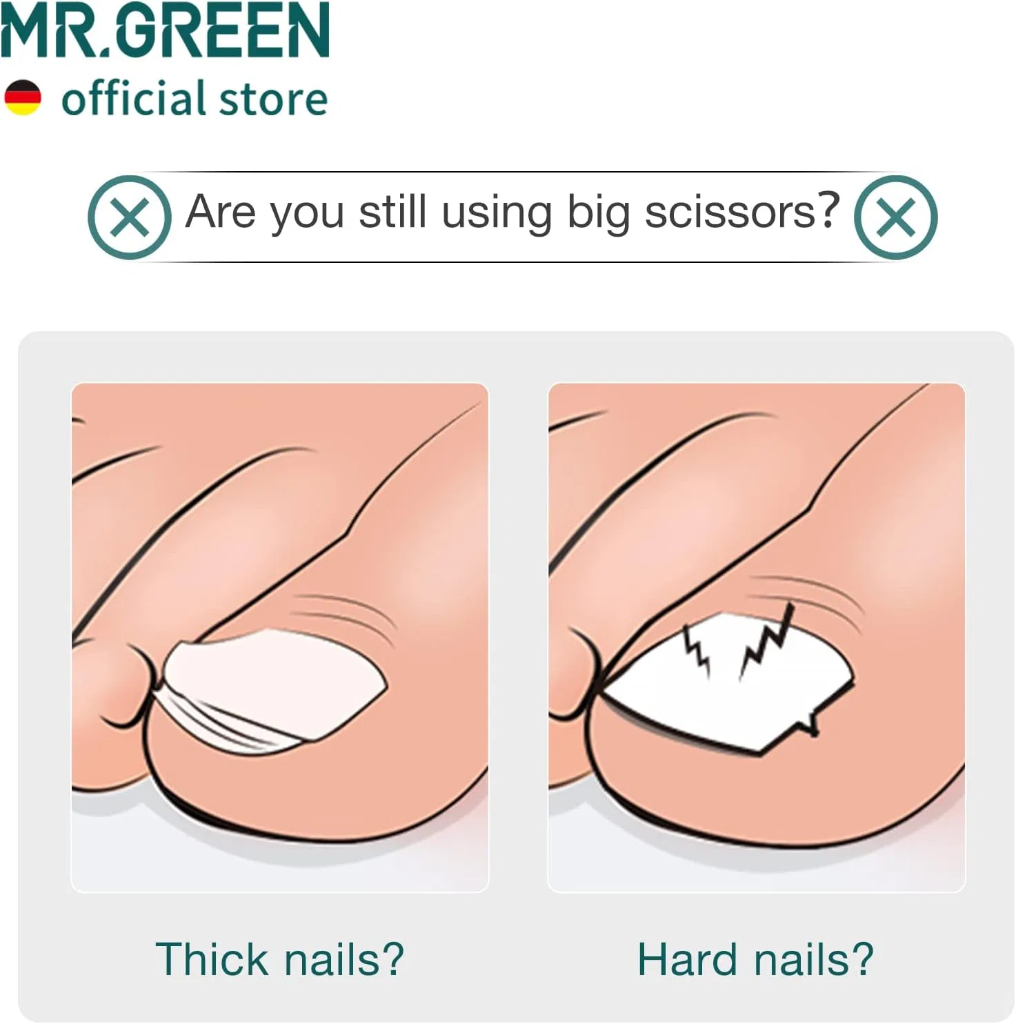 Кусачки для вросших ногтей MR.GREEN из нержавеющей стали, черные Mr.Green, Black + Nail Remover — фото 3