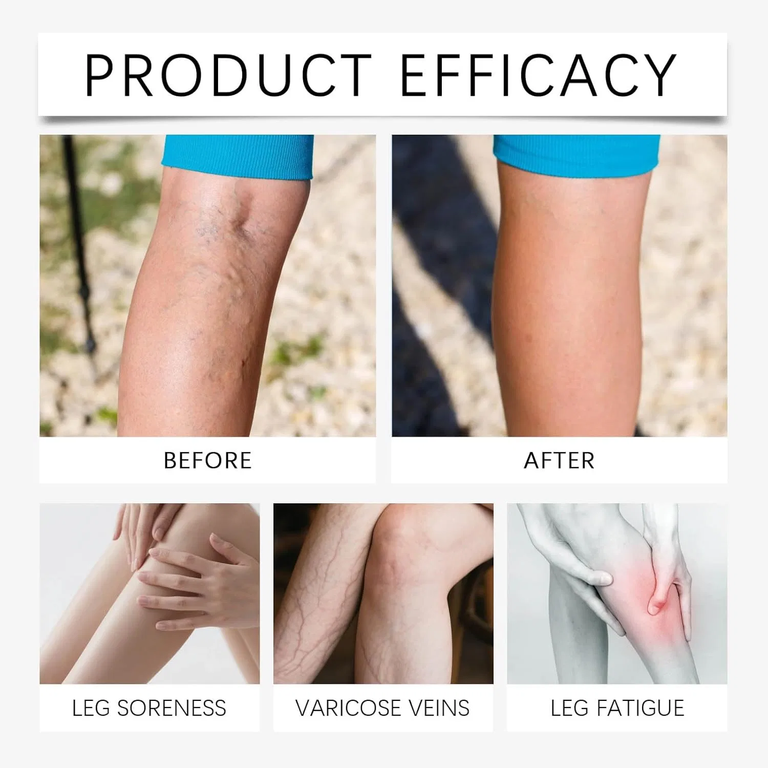 Пластыри Vein Ease Microdarts для лечения варикозного расширения вен Generic, 3Pcs — фото 3