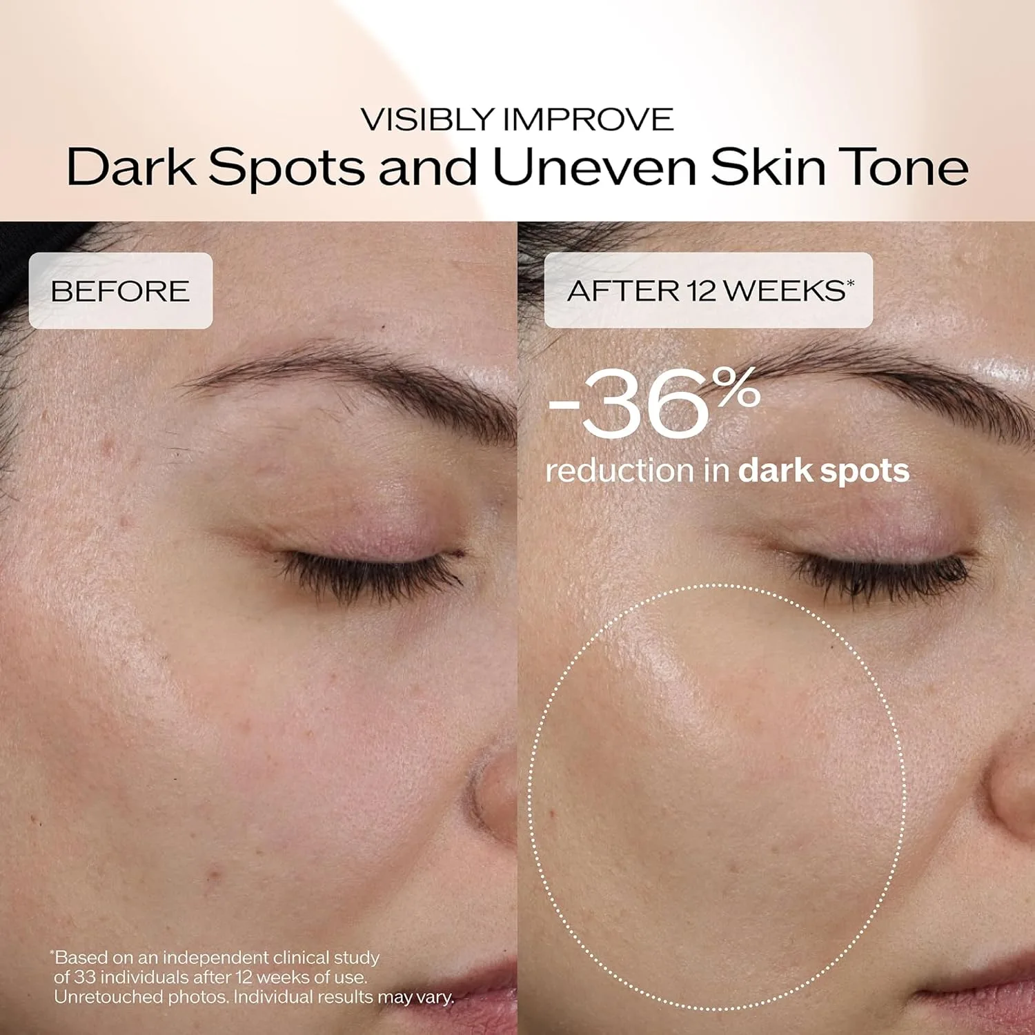 Shiseido Benefiance сыворотка для лица против темных пятен и морщин с ниацинамидом и растительным ретинолом, 8-часовая гидратация, некомедогенная, для всех типов кожи 50 мл (1 шт.) — фото 4