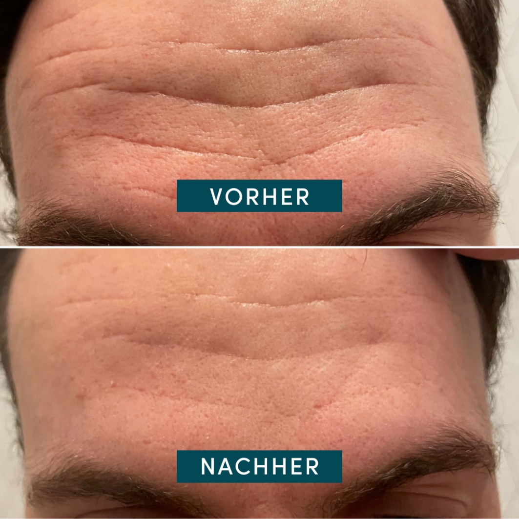Патчи под глаза Apricot — Gesicht patches mit niacinamid , вес, 100 г — фото 3