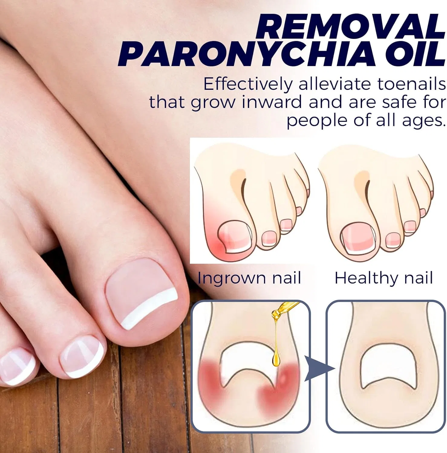 Масло для ногтей Toenailplus Anti Paronychia Relief Oil Lwuuywa — фото 4